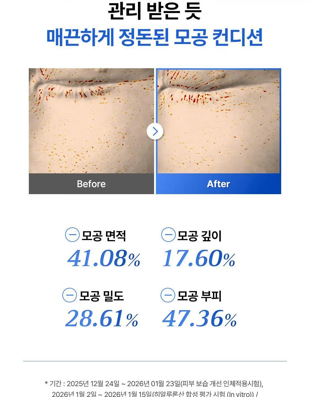 [리뉴얼/원조패드]코스알엑스 원스텝 패드 100매 4종 중 택1 상세페이지 122